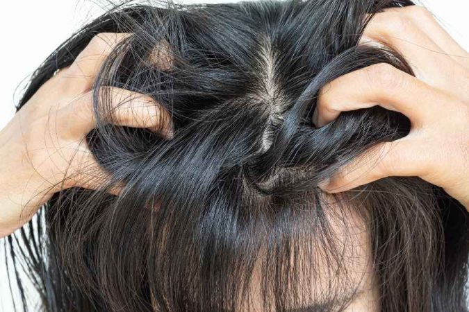 Gros plan sur des mains qui séparent des cheveux bruns et brillants pour inspecter les racines d'un cuir chevelu gras.